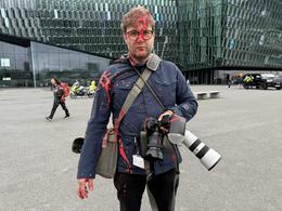 Red paint was splashed on Eyþór Árnason, the photographer for mbl.is.