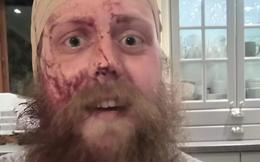 Barinn sundur og saman eftir umferðaratvik