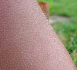 Tónlistin kitlar heilann