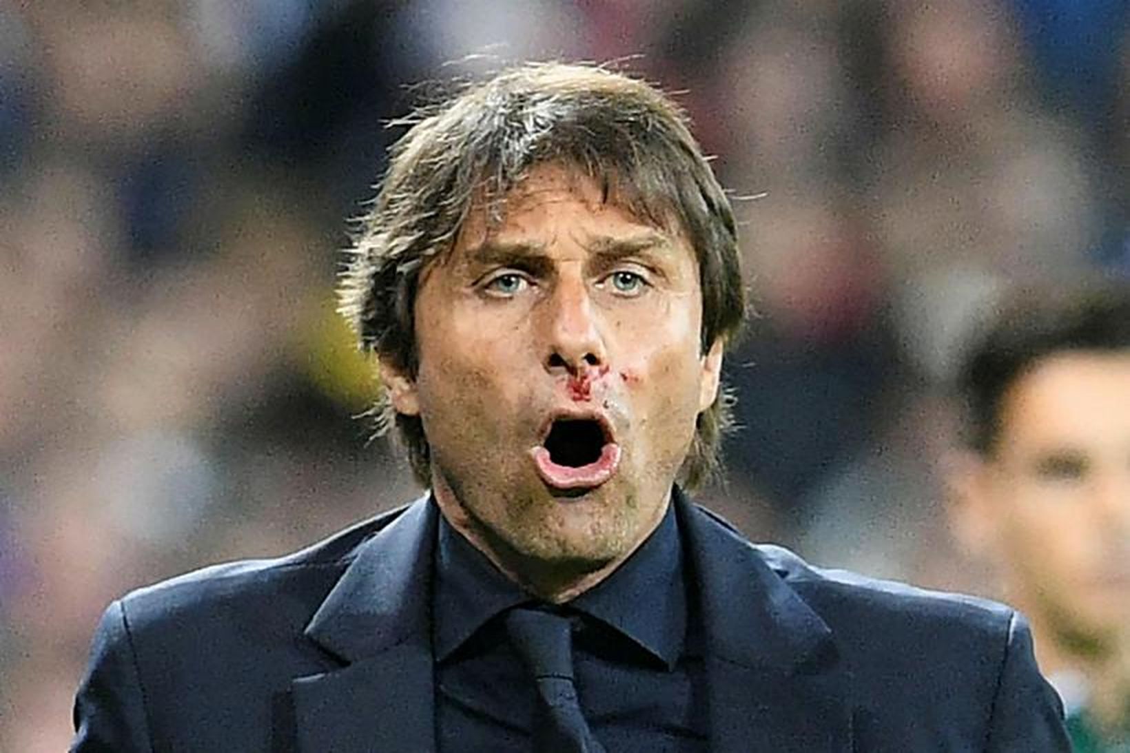 Fyrsti leikur Antonio Conte sem knattspyrnustjóri Chelsea er gegn West …