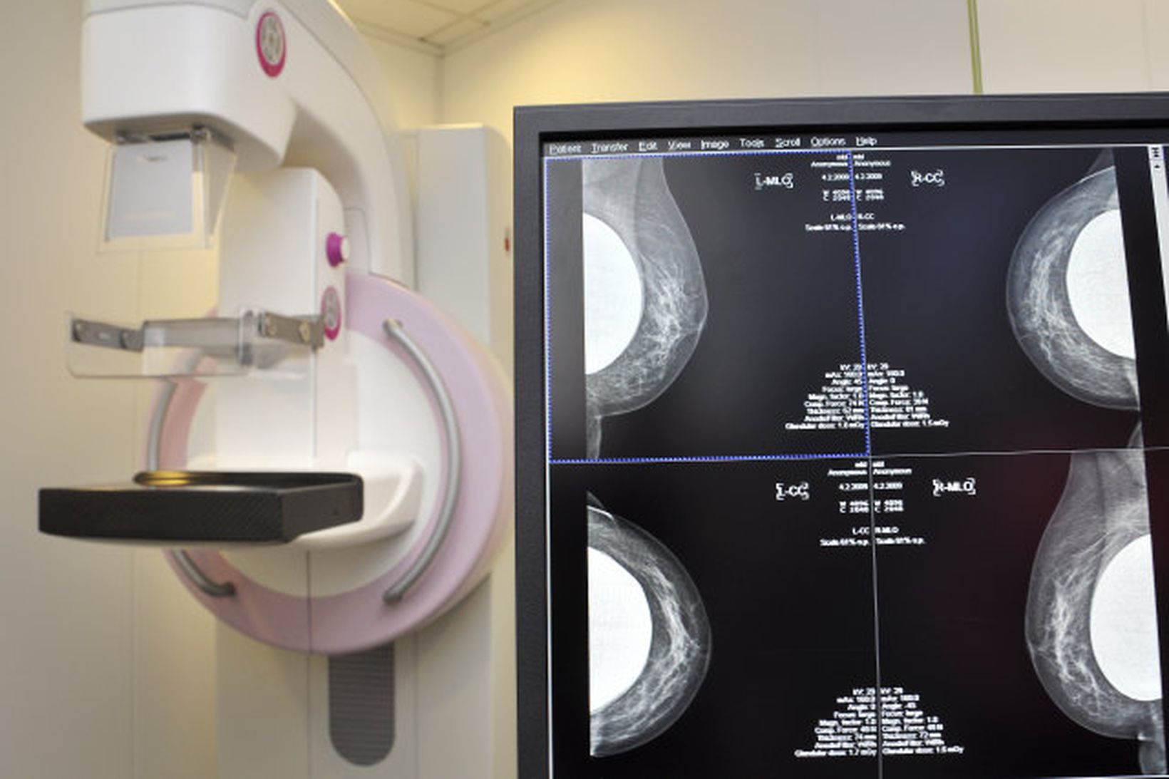 Tækjabúnaður í leitarstöð Krabbameinsfélags Íslands.