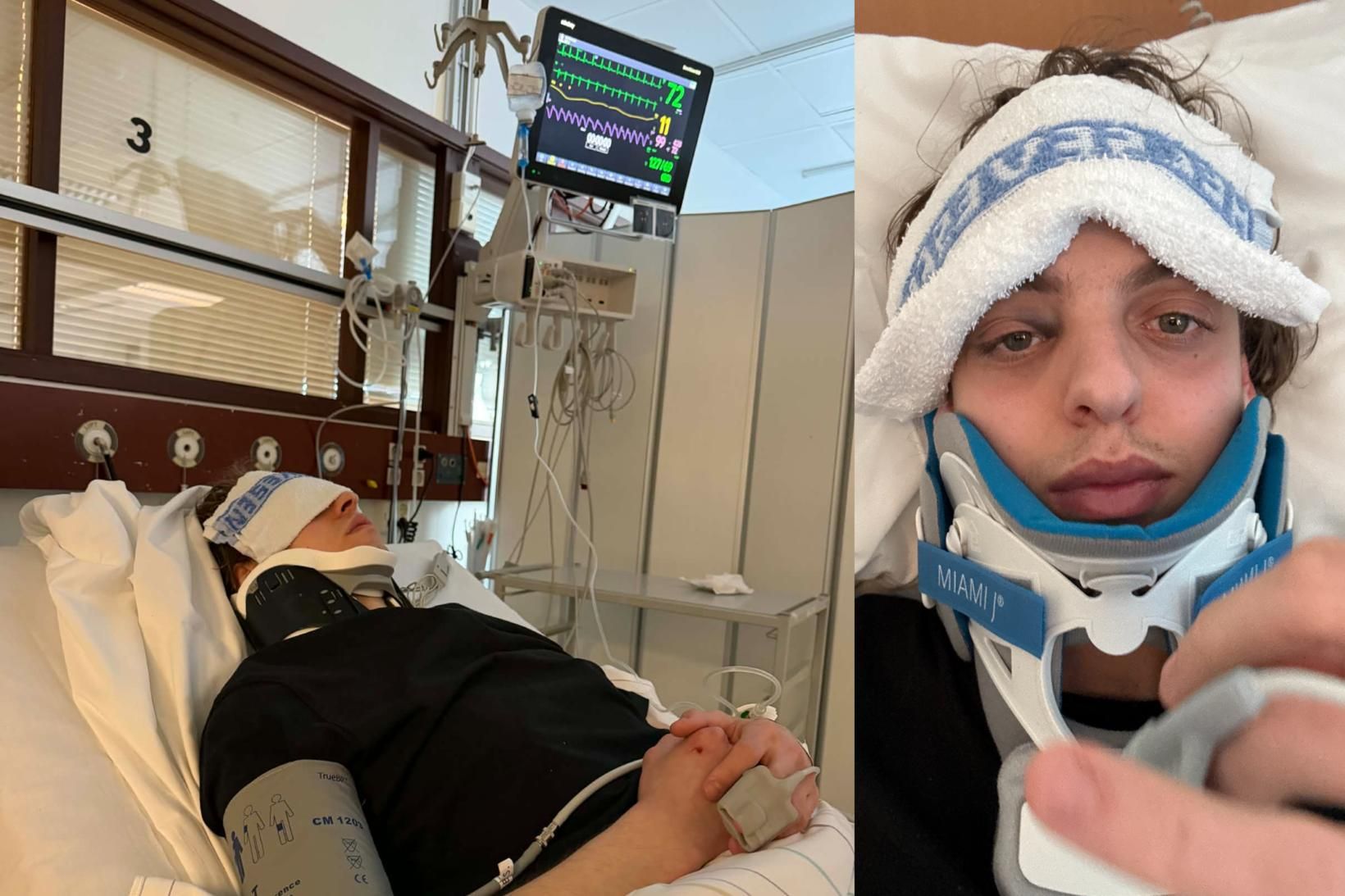 Höfuðkúpubrotinn eftir ákeyrslu