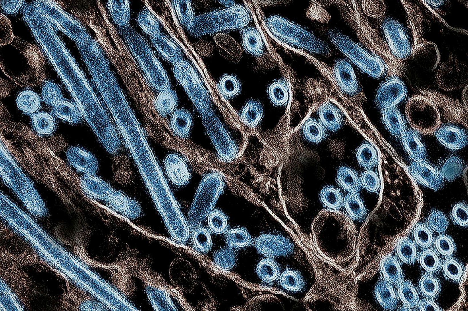 Smásjármynd sem sýnir fuglaflensu af H5N1-stofni.