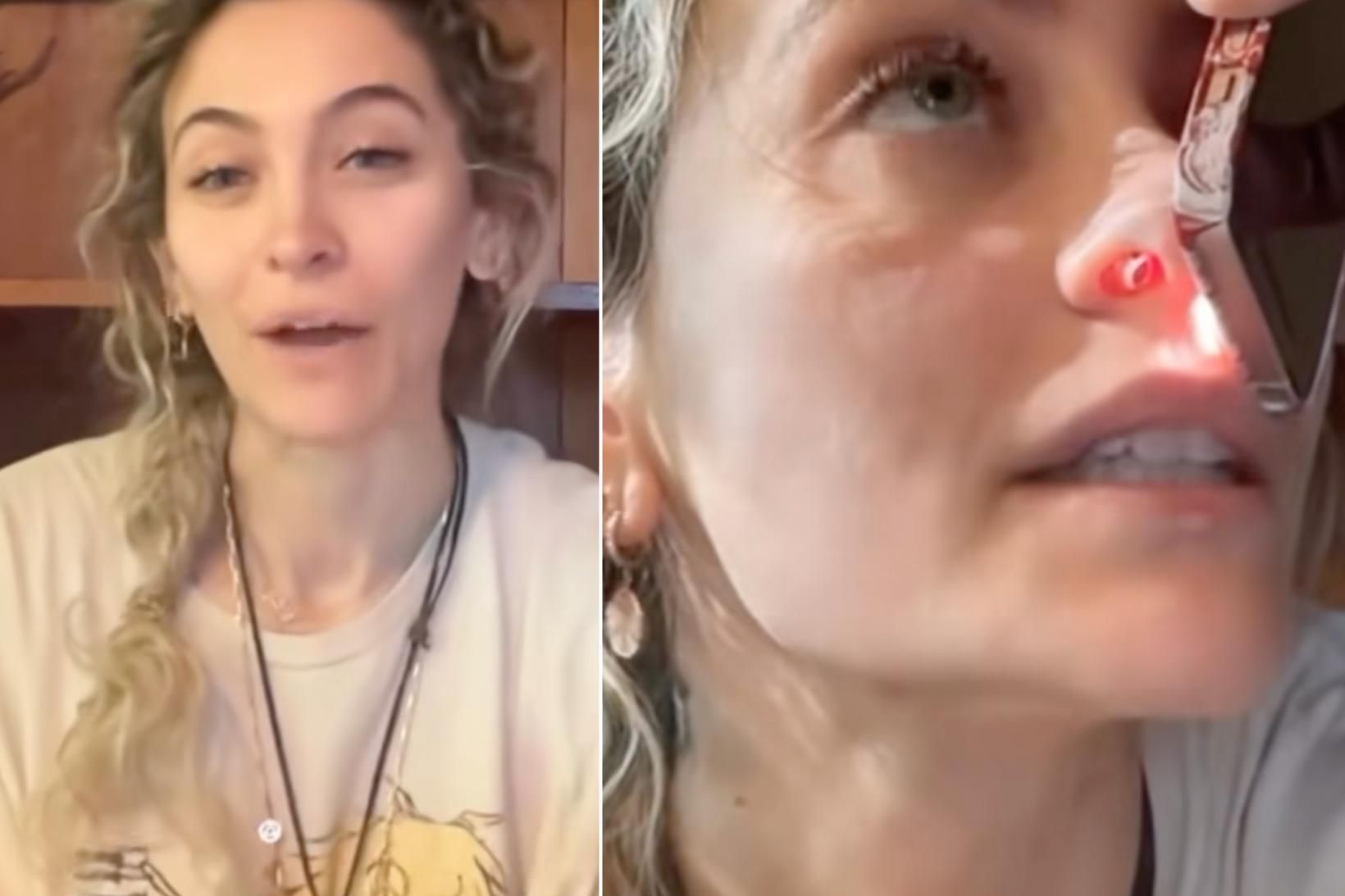 Paris Jackson sýnir afleiðingar eiturlyfjanna: „Þau eyðilögðu líf mitt“