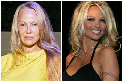 Pamela Anderson mætti óförðuð á tískuvikuna í París á dögunum. Myndin hægra megin var tekin …
