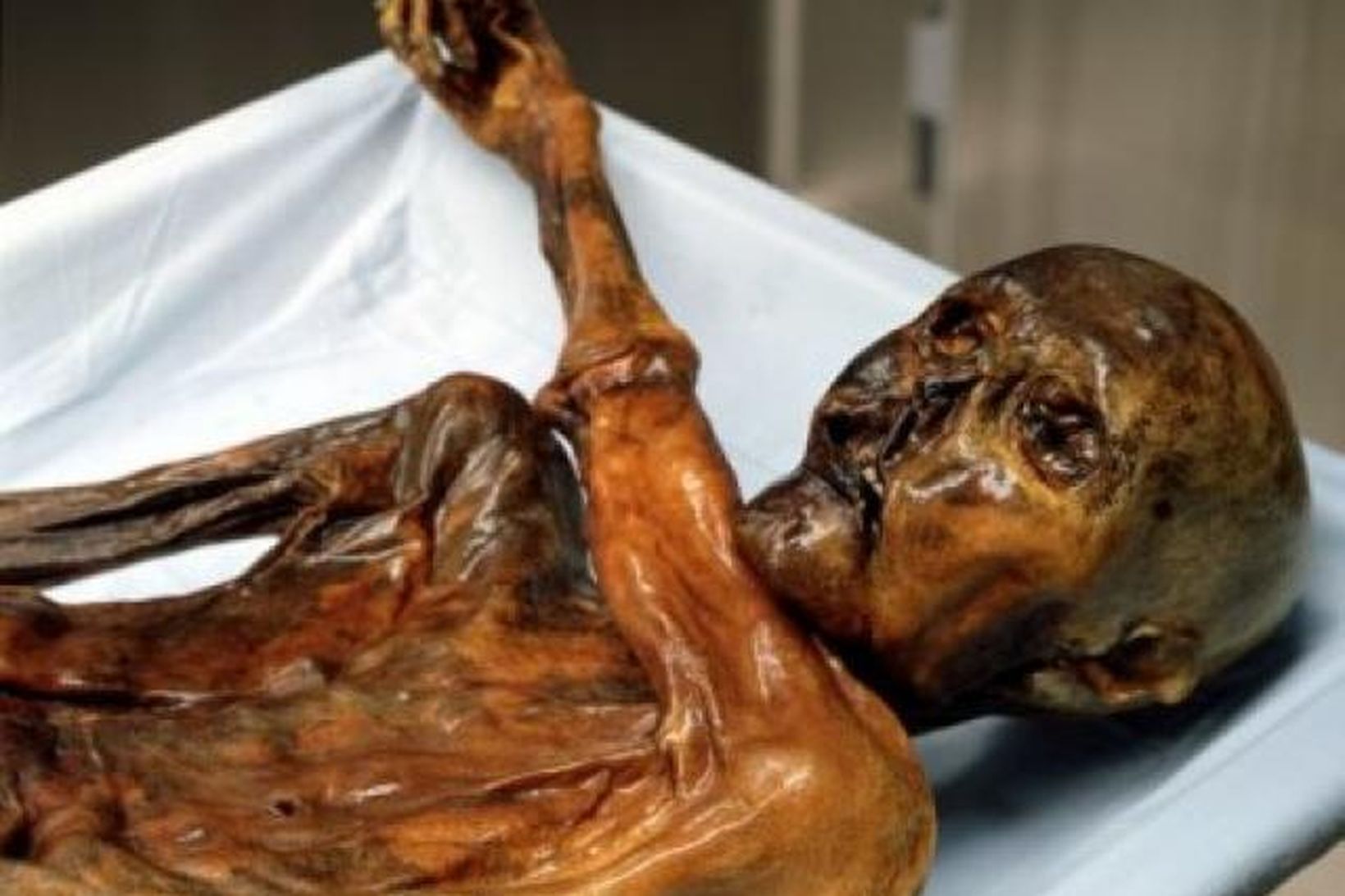Ötzi hefur varðveist ótrúlega vel í ísnum í Ölpunum í …