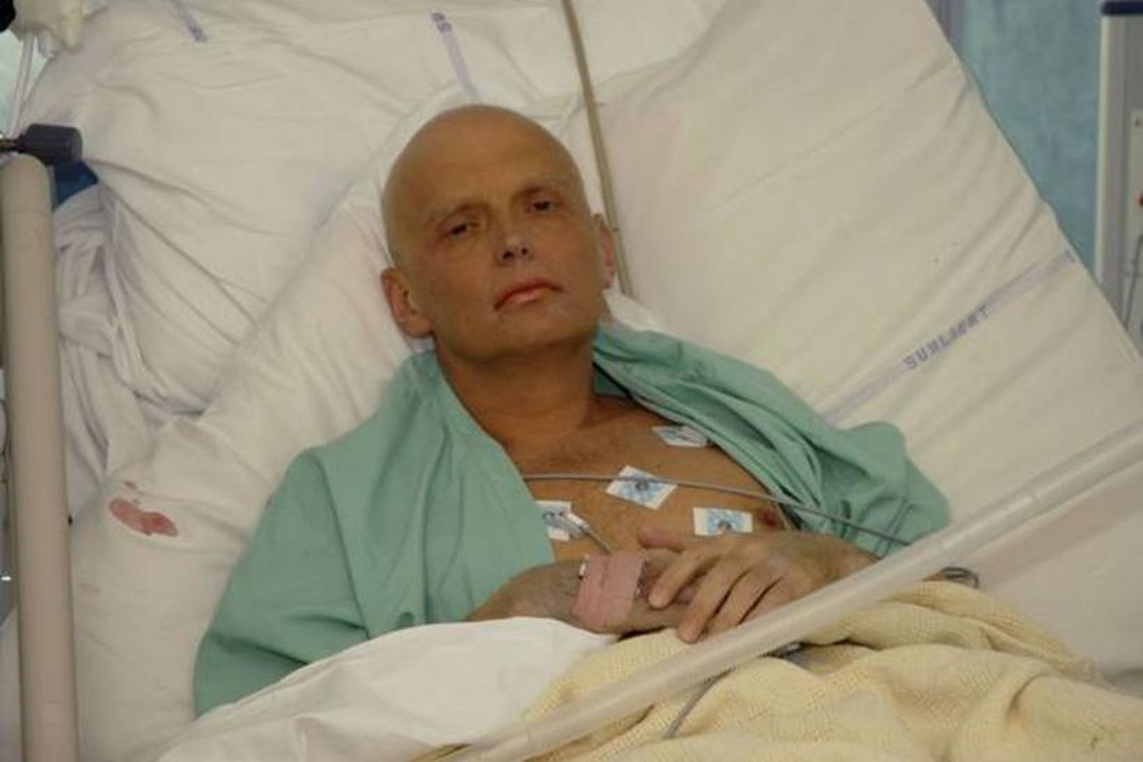 Alexander Litvinenko á sjúkrahúsinu eftir að áhrif eitrunarinnar fóru að …