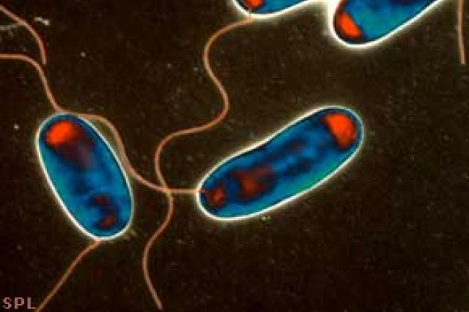 Hermannaveiki orsakast af bakteríu sem kallast Legionella pneumophila.