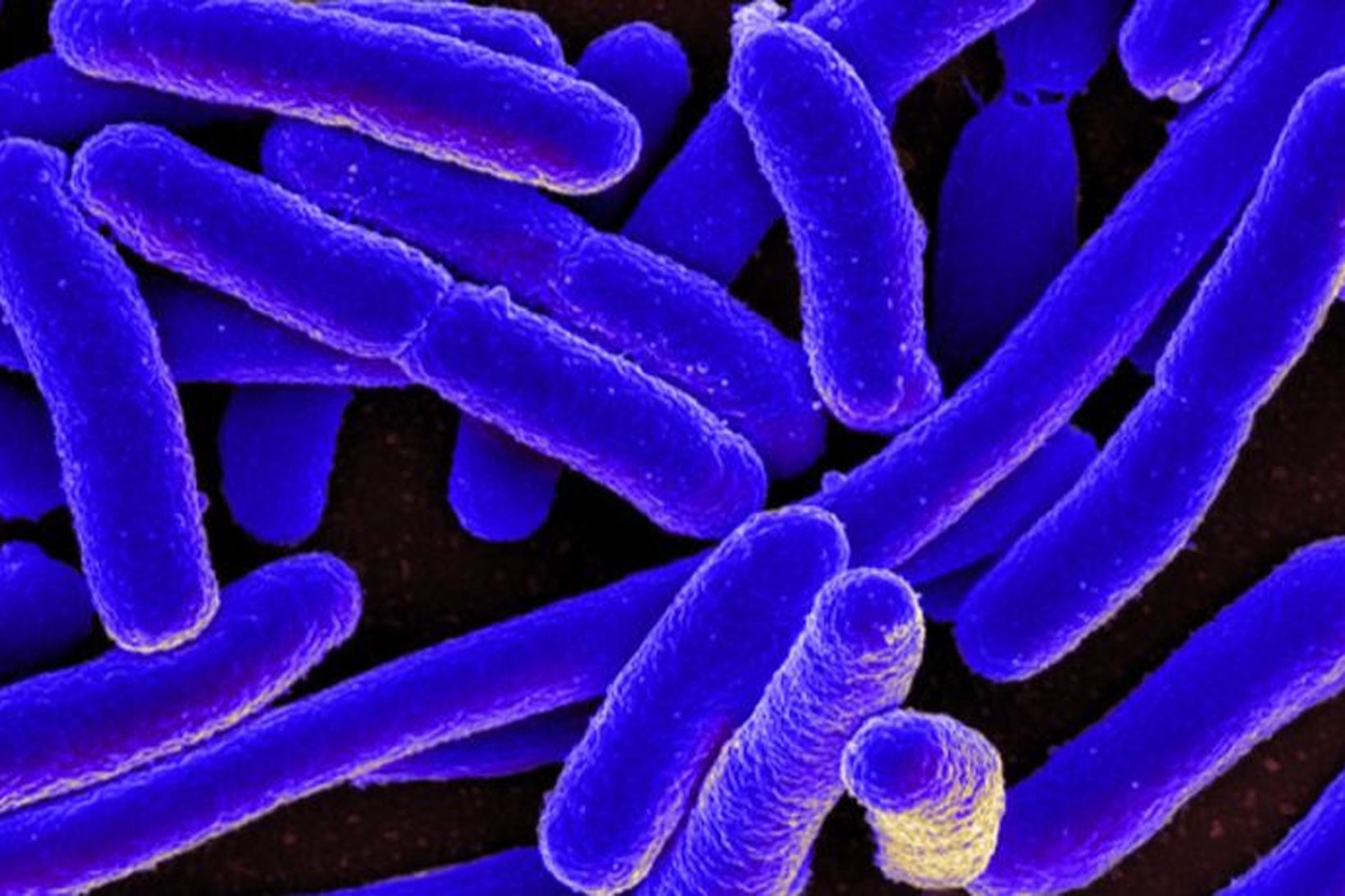 E. coli-baktería.