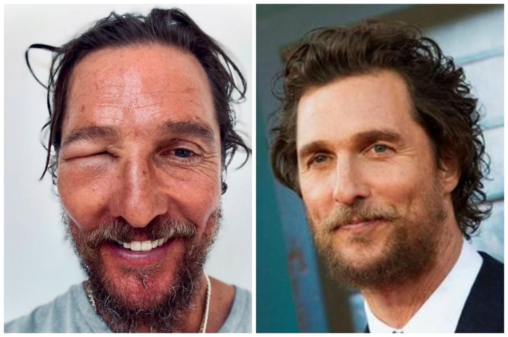 Matthew McConaughey stunginn illa