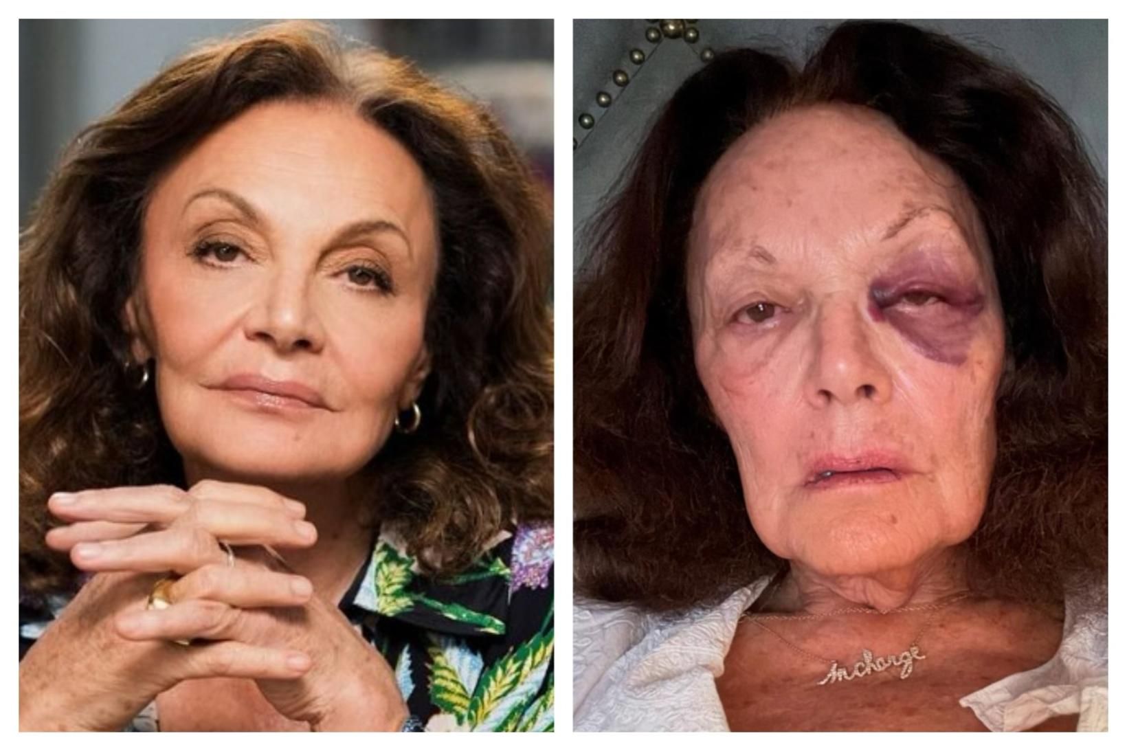 Diane von Furstenberg er sterk kona sem hefur byggt upp …