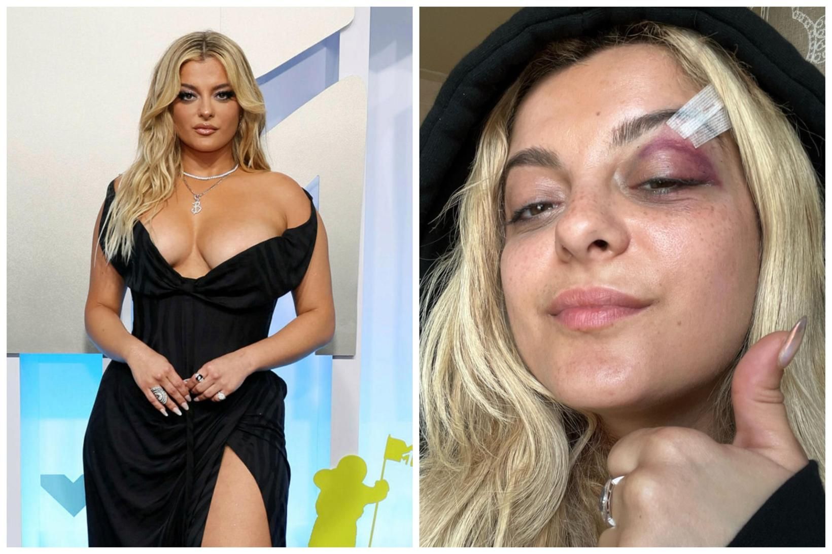 Bebe Rexha fékk slæmt högg í andlitið frá aðdáanda sínum …