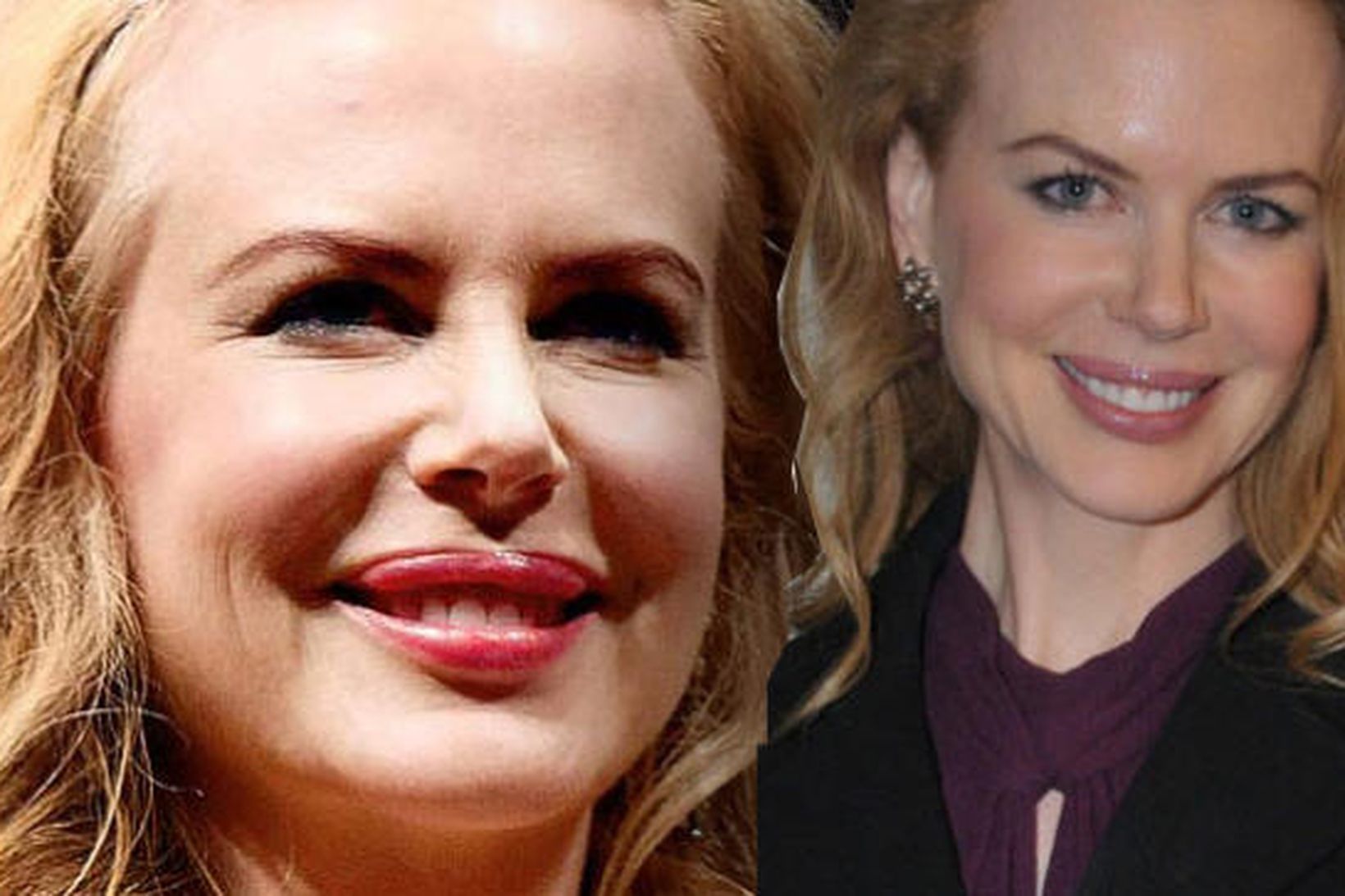 Nicole Kidman nú og þá. Munurinn á vörunum er mikill.