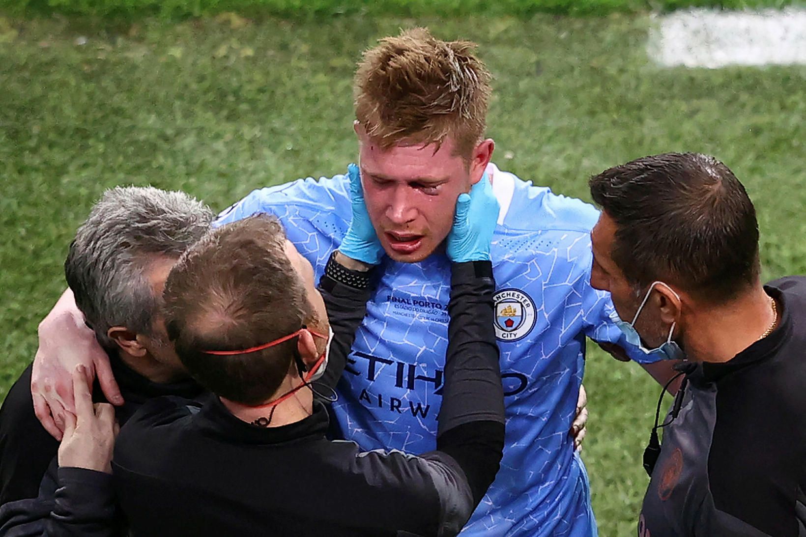 Kevin De Bruyne fékk þungt högg í úrslitaleiknum.