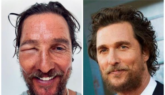 Matthew McConaughey stunginn illa