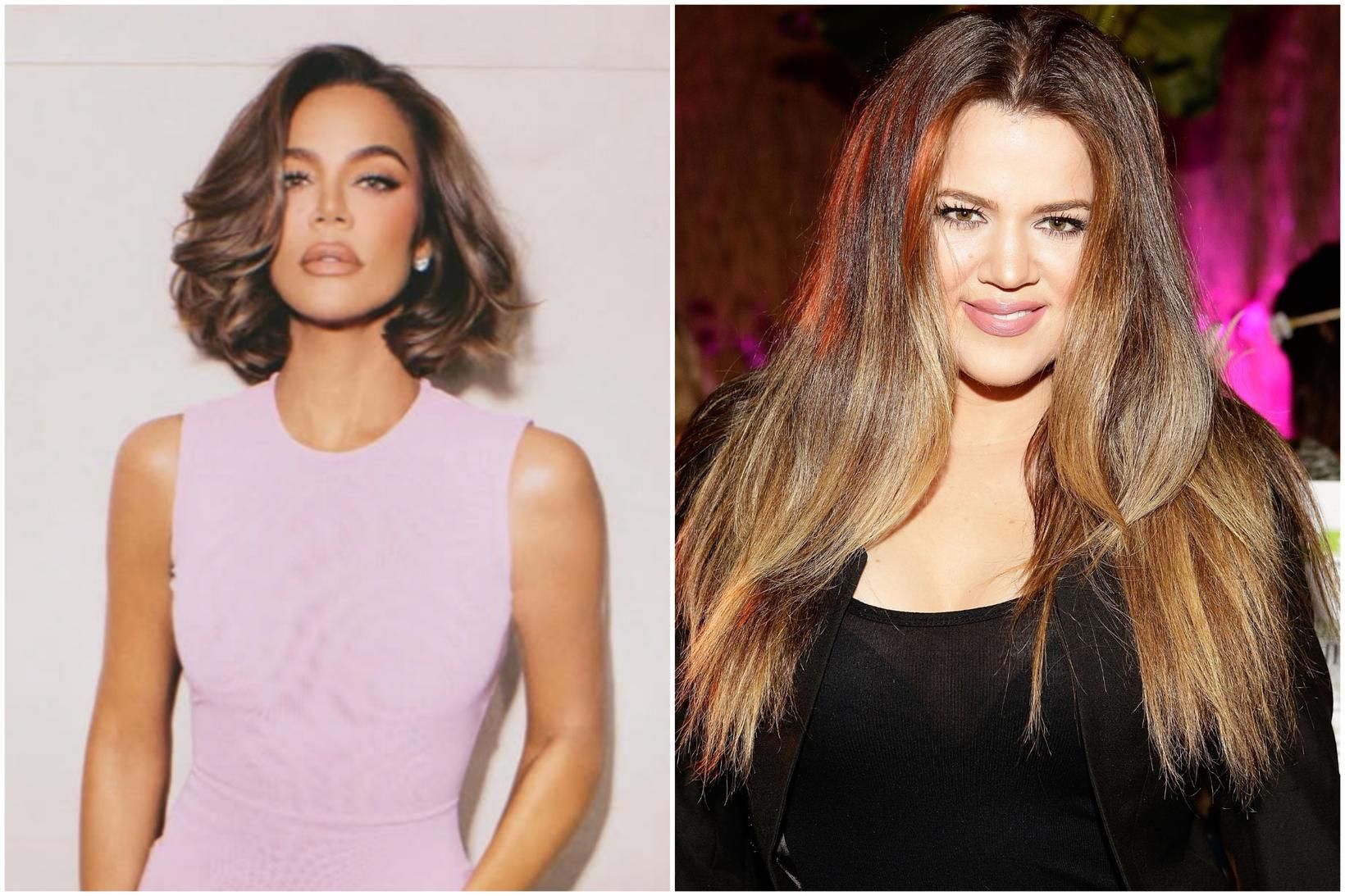 Khloé Kardashian segir frá öllum þeim fegrunaraðgerðum sem hún hefur …
