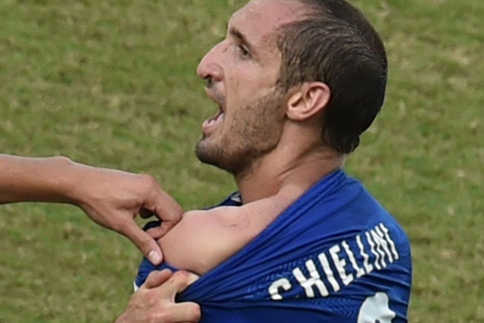 Ítalski varnarmaðurinn Giorgio Chiellini reyndi að sýna dómaranum meinta bitáverka en dómarinn lét leikinn halda …