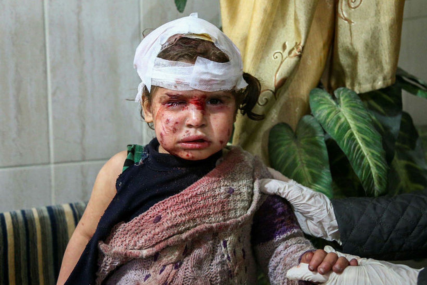 Barn sem særðist í loftárásum stjórnarhersins í Austur-Ghouta í gær.