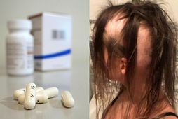 Gigtar- og æxlishemjandilyf hafa gefið góða raun á sjálfsofnæmissjúkdóminn Alopecia.