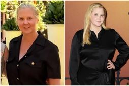 Amy Schumer.
