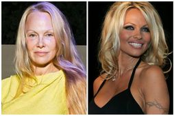 Pamela Anderson mætti óförðuð á tískuvikuna í París á dögunum. Myndin hægra megin var tekin …