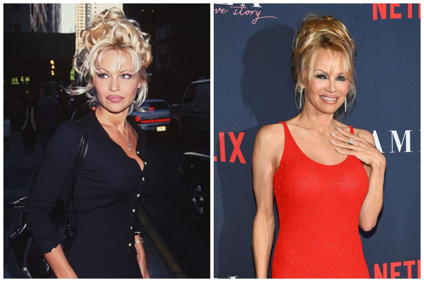 Pamela Anderson segist hafa verið óánægð með útlit sitt þar …