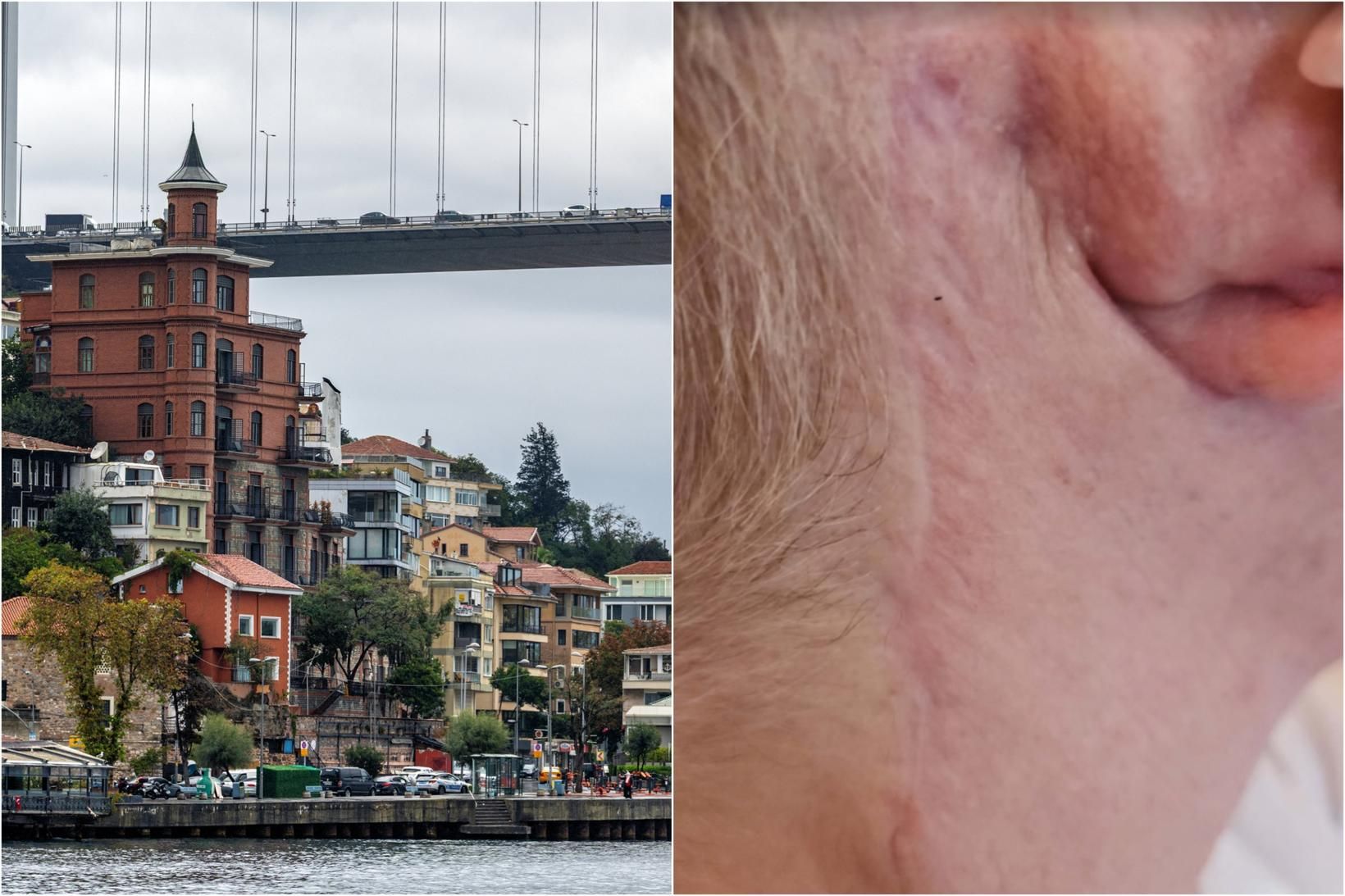 Íslensk kona löskuð eftir andlitslyftingu