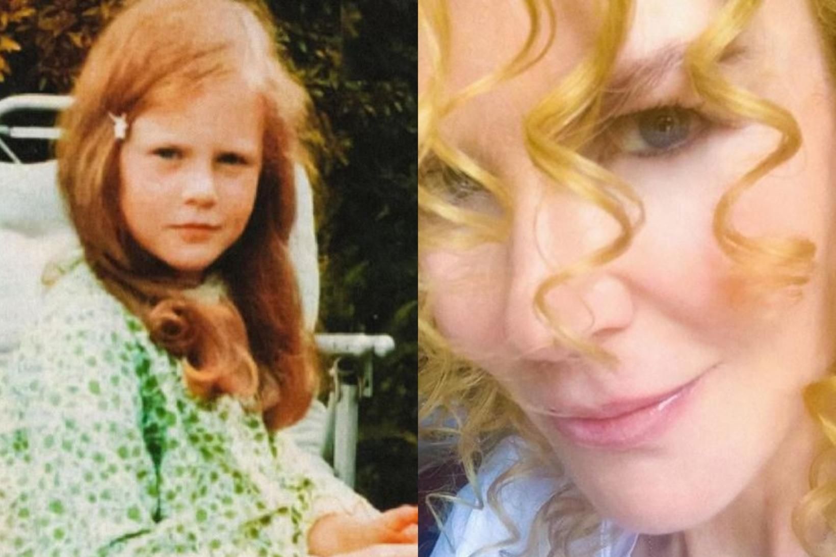 Nicole Kidman þá og nú.
