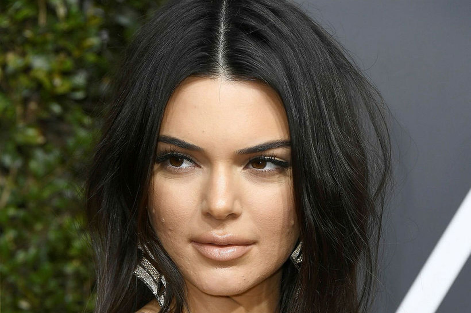 Kendall Jenner er með slæma húð.