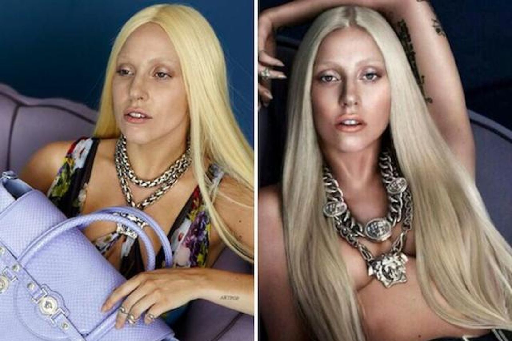 Lady Gaga fyrir og eftir fótósjopp. Munurinn er mikill.