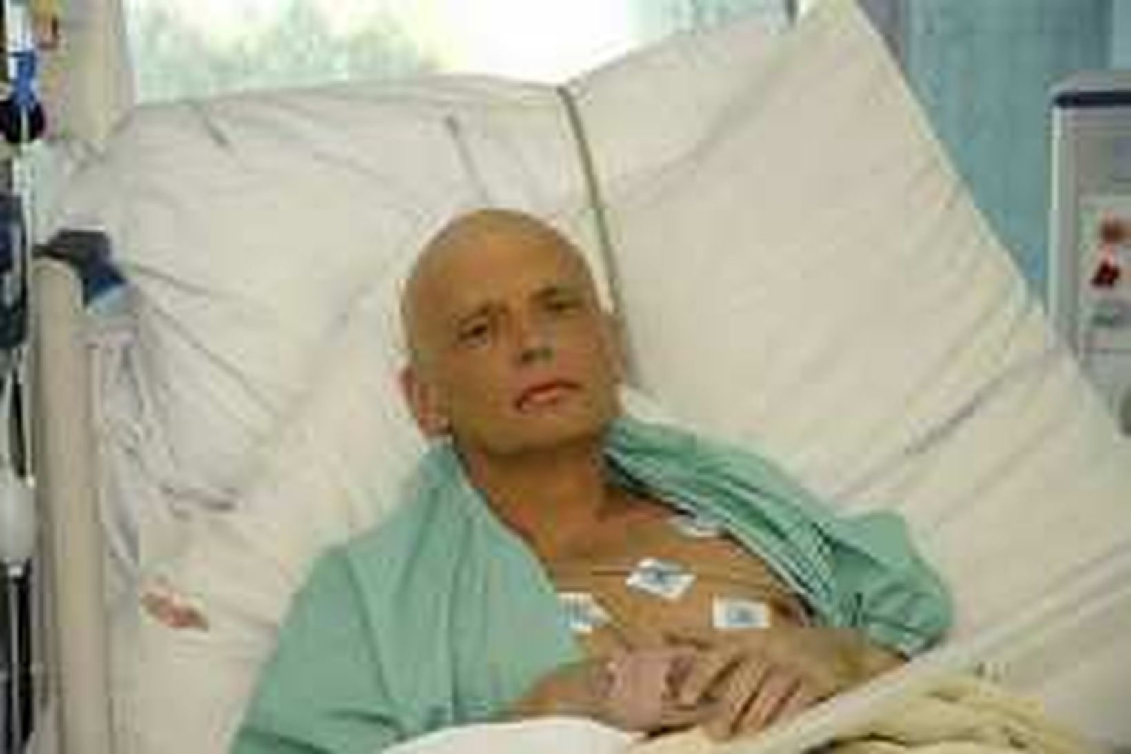 Alexander Litvinenko á sjúkrabeði.