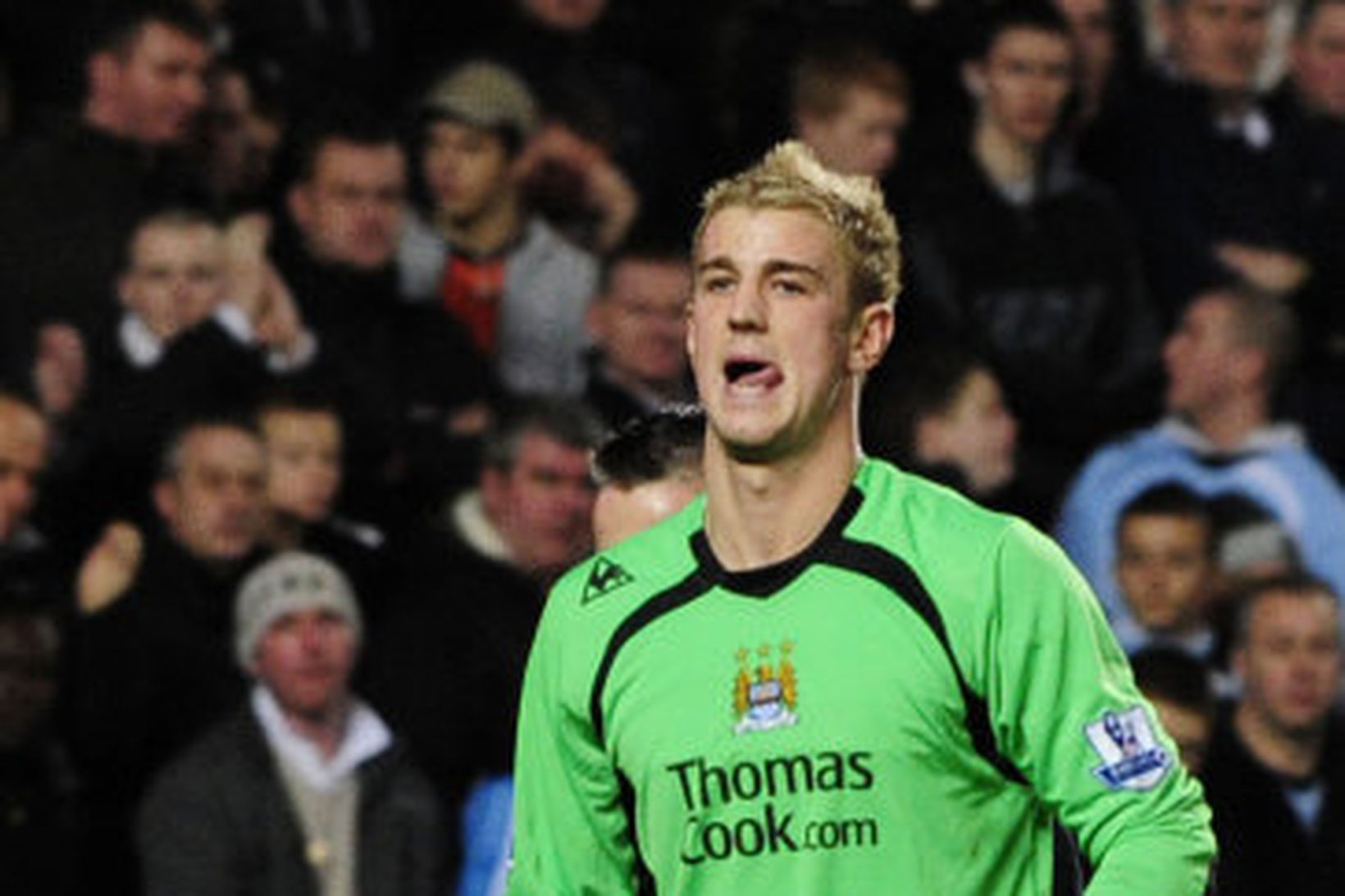 Joe Hart haltrar af velli í leiknum í dag.